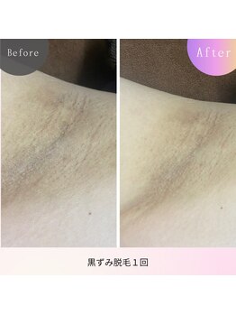 レジュイール(Rejouir)/