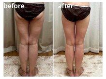 ヨサパーク ルナ(YOSA PARK)/下半身もお任せください！