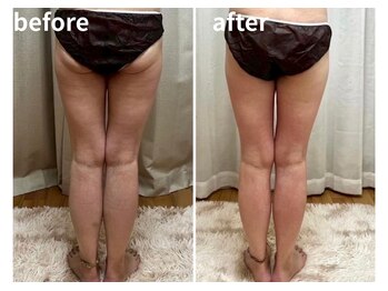 ヨサパーク ルナ(YOSA PARK)/下半身もお任せください!