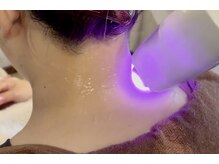 リノン(Rinon)の雰囲気（美肌光脱毛、太い毛はもちろん産毛、細い毛にも効果があります。）