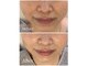 リッチベル(richbelle)の写真