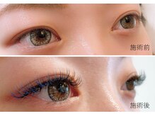 ドーズリュバンドール(DOUZE Ruban ｄ'or)/ラッシュシャドウ＊