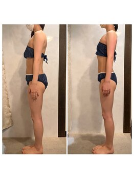 骨盤ストレッチ整体 b/姿勢矯正