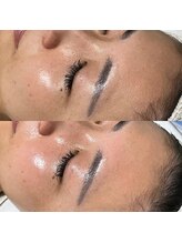 ルアラナ(Lualana)/赤みやゴワツキにはアンストレス