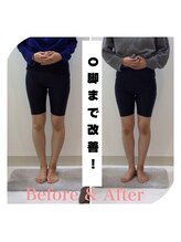 スタイルラボ高松/産後骨盤矯正の効果♪