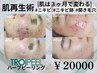  【まるで赤ちゃん肌☆】韓国最先端ハーブピーリング120分￥20000