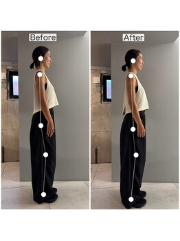 シャウルデッサン(CHARLESDESSIN)/フェムケア矯正