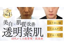 アロラヴィ(AroRavi)