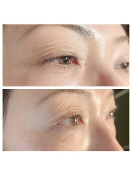 グービー(goovy)の写真/丁寧なカウンセリングで叶える、大人女性の理想の目元♪