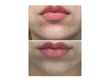 バルディーナ(BALDINA)の雰囲気（【効果を即実感】肌状態に合わせた施術で、見せたくなる肌へ）