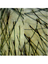 オレオール(aureole)/頭皮の臭いケア