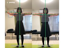 エヴォストレッチ(EVO STRETCH)/50代女性【肩甲骨の動き改善】