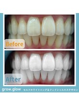グロウ グロウ(grow.glow)/仙川ホワイトニング