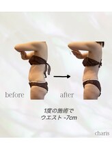 カリス(charis)/ウエストマイナス7cm