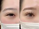 ルイール 光の森(Luire)の写真/LEDマツエク×まつげパーマの同時施術で目幅2倍！！逆まつげの方やマスカラを塗る時間もない方へ◎