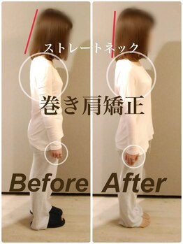 ティーエスエル とがし整体ラボ(TSL とがし整体 Labo)/小顔矯正・骨盤矯正・反り腰