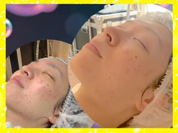 フォト トリートメント シエル(ciel)