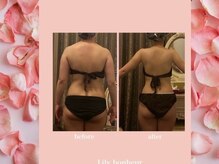 リリー ボヌール(Lily bonheur)/美腕ボディトリートメント