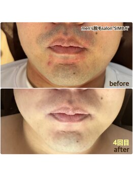 メンズ シンバ(SIMBA)/◯before→after◯