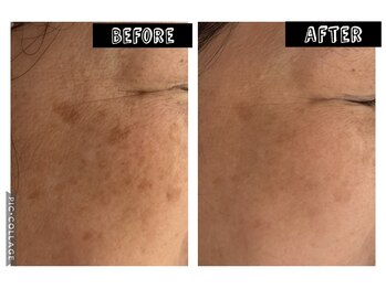 いおり骨盤整体 リブート(RE:BOOT)/シミケア　お客様の変化