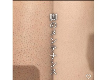 ネムレル森(Nemureru森)/脱毛【水巻/八幡西区/遠賀】