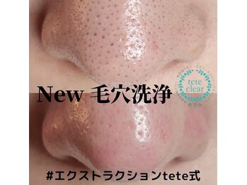 beauty salon Miiru/◇施術イメージ◇