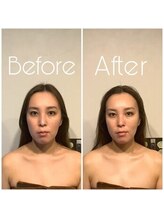 グレースフィオーレ 町田店(gracefiore)/ビフォーアフター/施術1回の効果