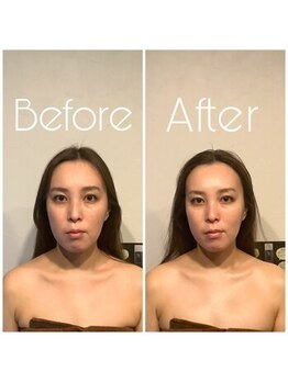 グレースフィオーレ 町田店(gracefiore)/ビフォーアフター/施術1回の効果