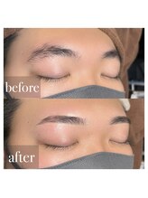 エムディラボ 金沢竪町店(MDラボ)/BeforeAfter