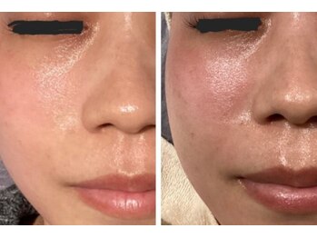 ラポール 野並店(Rapport)/