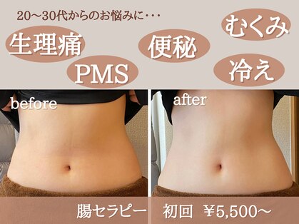 ナチュモア(natyumoi)の写真