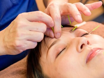 メディカルエステ 田奈鍼灸院の写真/【本格施術!辛い頭痛/眼精疲労/ストレスを和らげ質の良い睡眠を実現★】目元が軽く、視界スッキリに!