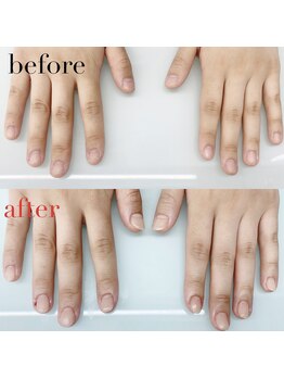 アイネイルズ 布施店(I.NAILS)/深爪/深爪矯正/自爪風ネイル