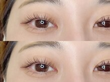 シクラプ(siklap)/ラッシュリフト