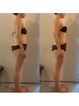 ラナ 京都西院店(Lana)/よもぎ蒸し＆リンパマッサージ