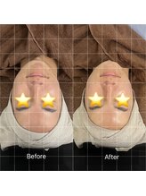 トニック バイ まつもと整骨院鍼灸院(Tonic)/★Before After★豊中／コルギ