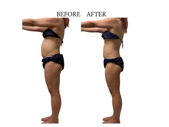 ヨサパーク サノン(YOSA PARK Sanon)/ よもぎ蒸し/痩身/リンパ