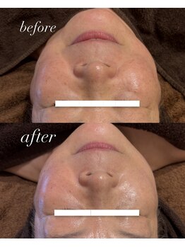 エル(Elle)/たった30分！リフトアップケア