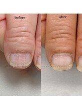 スマイルニコ(smile nico)/