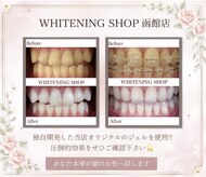 ホワイトニングショップ 函館店(Whitening Shop)