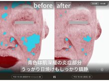 ダイヤモンドトゥルース(Diamond truth)の雰囲気（お肌の赤みや日焼け、シミ対策まで何なりとお申し付けください。）