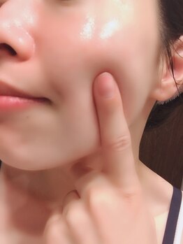 ヒーリス デットクス サロン(Healiss detox salon)/浮腫み・リフトアップ対策／池袋