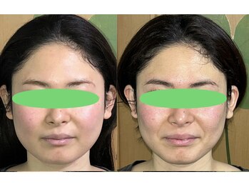 ふくふく/小顔矯正+骨盤矯正