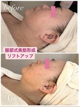 リノリー(rinory)/１回の結果です