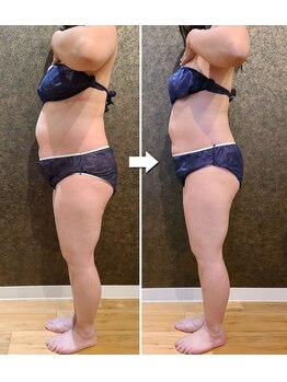 ワンルーム(1ROOM)/