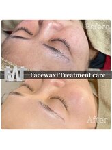 モンクラッシー(Mon classy)/即潤いのあるすべすべ水光肌へ