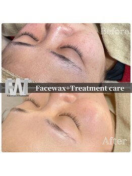 モンクラッシー(Mon classy)/即潤いのあるすべすべ水光肌へ