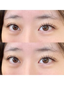 ネオリーブサイン(Neolive sign)/