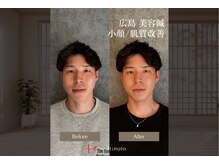 ヒノト(Hinoto)