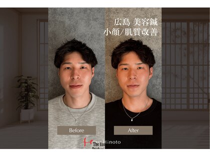 ヒノト(Hinoto)の写真